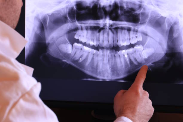 Best Chipped Tooth Repair Near Me  in Cashton, WI